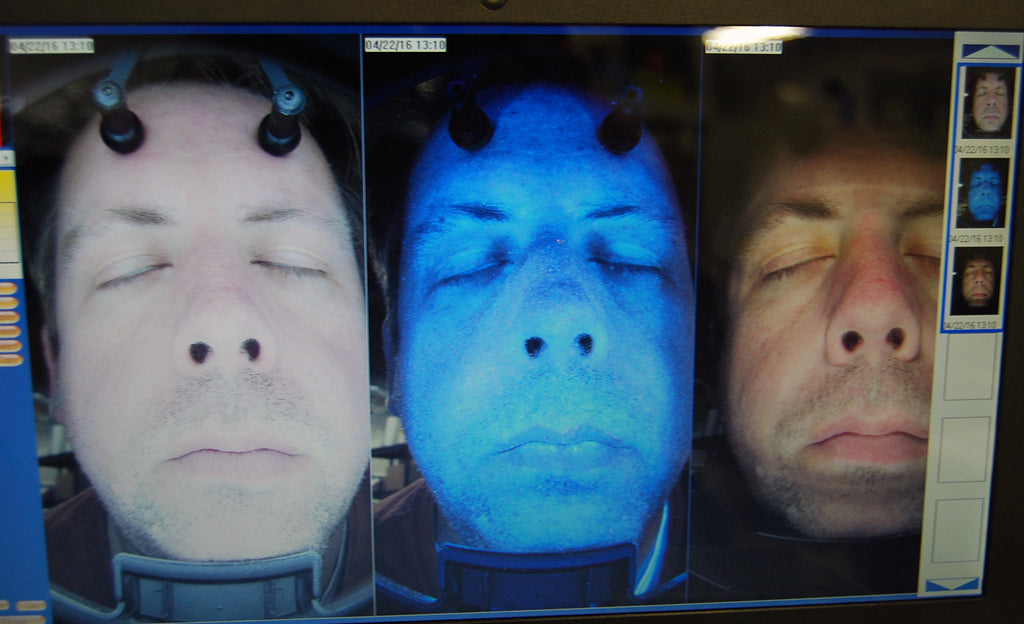 Eloscan Pro Facial Face Analysis System 6 Precise Facial Elements Laptop & Cart