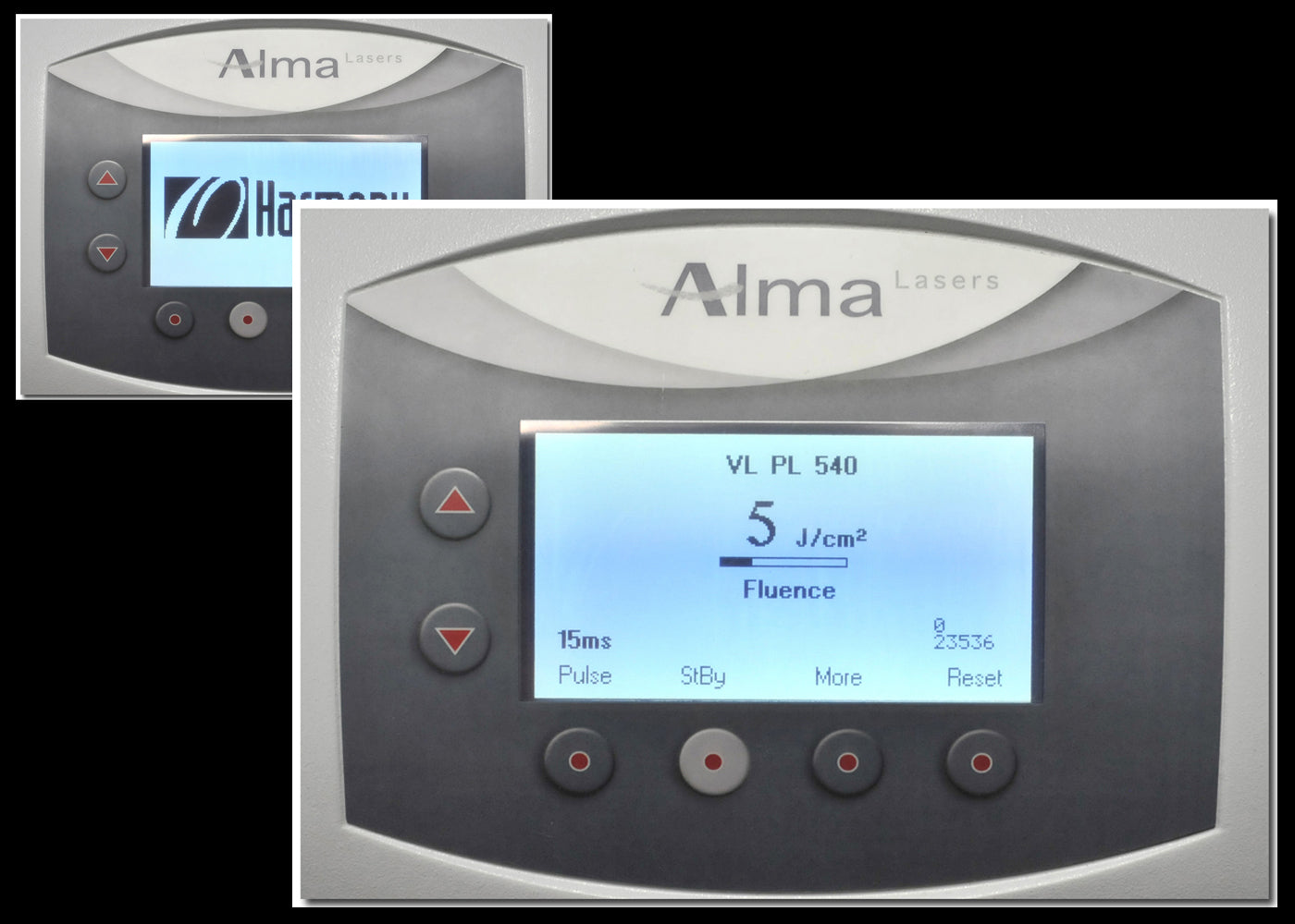 2006 Alma Laser Harmony 540 570 QS1064 HandPcs Q-Switched QS 1064 Tattoo Removal