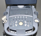 Siemens ACUSON X150 Ultrasound Sonogram Doppler Imaging Pulsed Wave System X 150