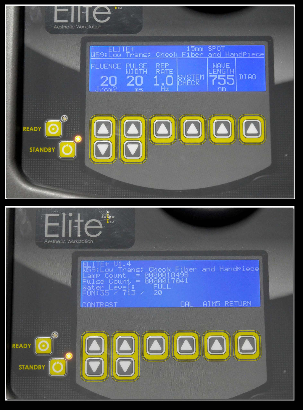 2008 Cynosure Apogee Elite Laser Removal Lesion YAG 1064 755 Dual Wavelength
