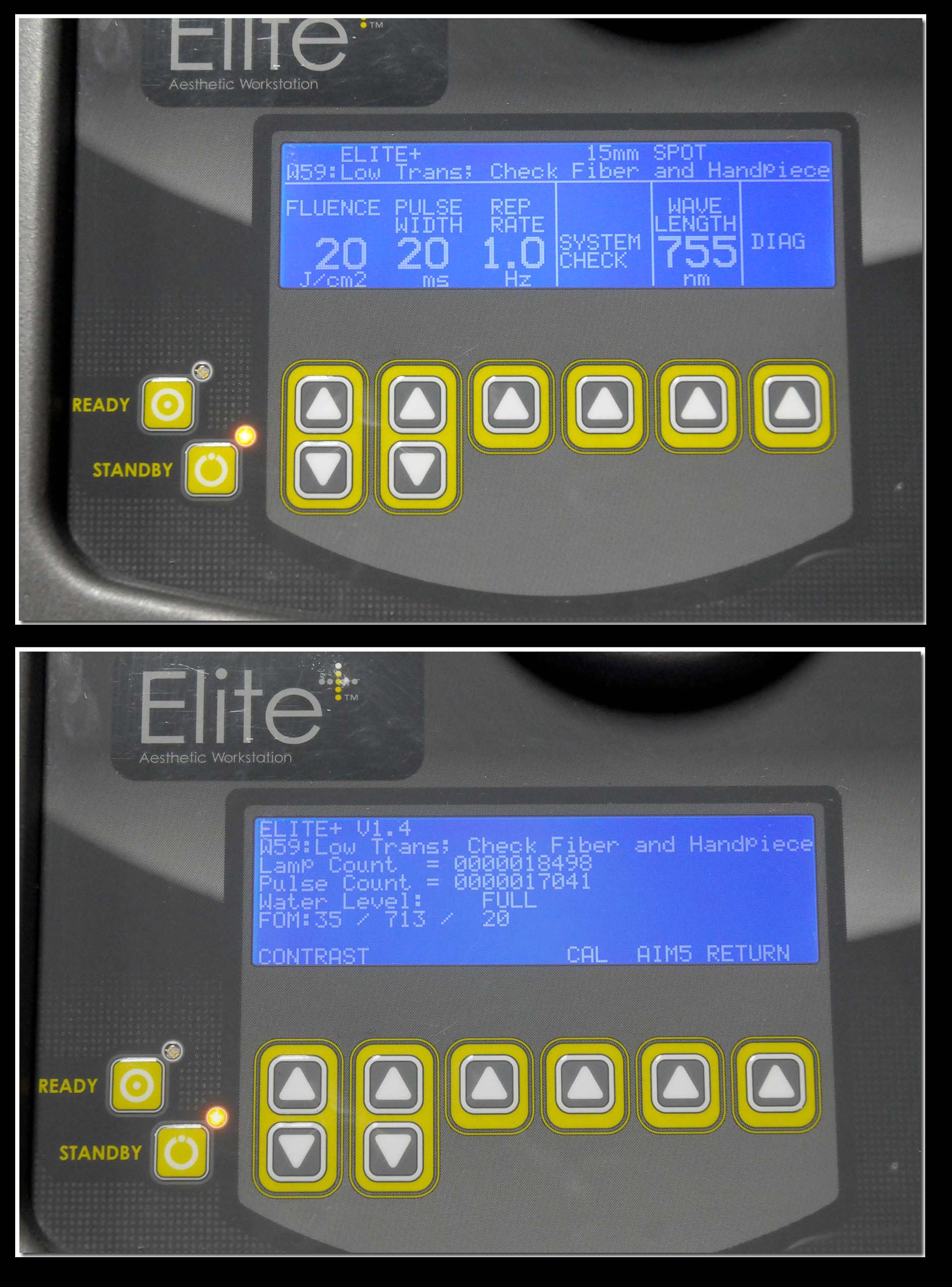 2008 Cynosure Apogee Elite Laser Removal Lesion YAG 1064 755 Dual Wavelength