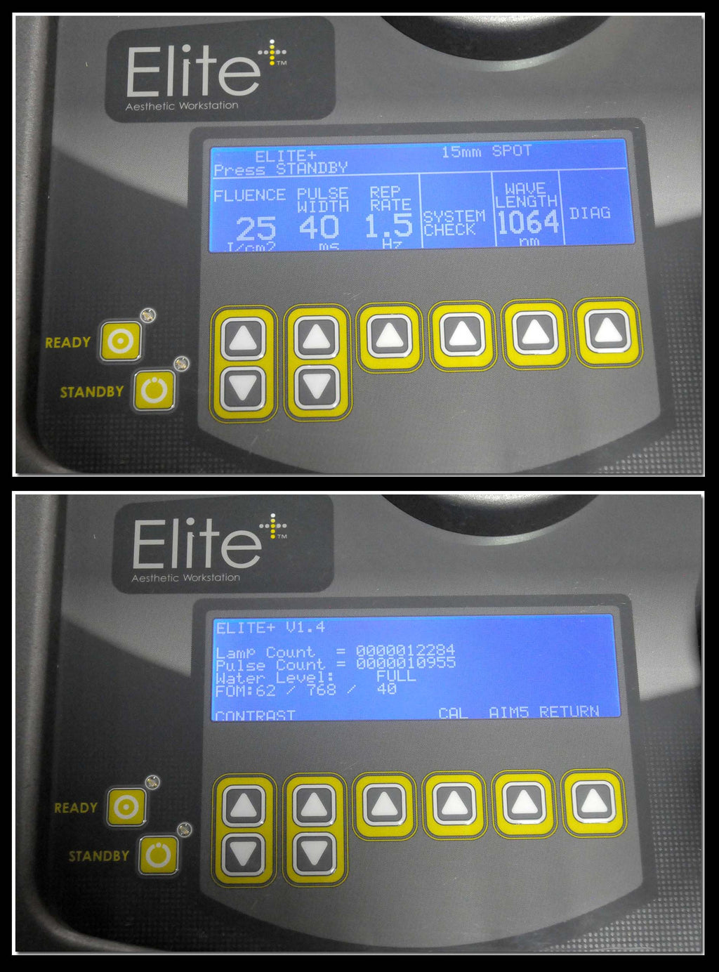 2008 Cynosure Apogee Elite Laser Removal Lesion YAG 1064 755 Dual Wavelength
