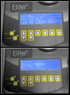 2008 Cynosure Apogee Elite Laser Removal Lesion YAG 1064 755 Dual Wavelength