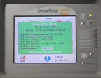 2008 Cynosure SmartLipo MPX 24 Watt Nd:Yag Laser System 1064nm 1320nm Facial Leg