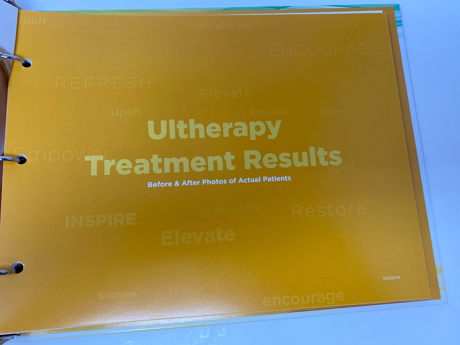 Ultherapy Binder Lift Eyebrow Neck Tissue Before & After Treatment Slideshow