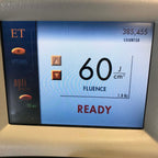 ESC Lumenis LightSheer Light Sheer ET E T 810 Diode Laser 400 ms Chill Tip