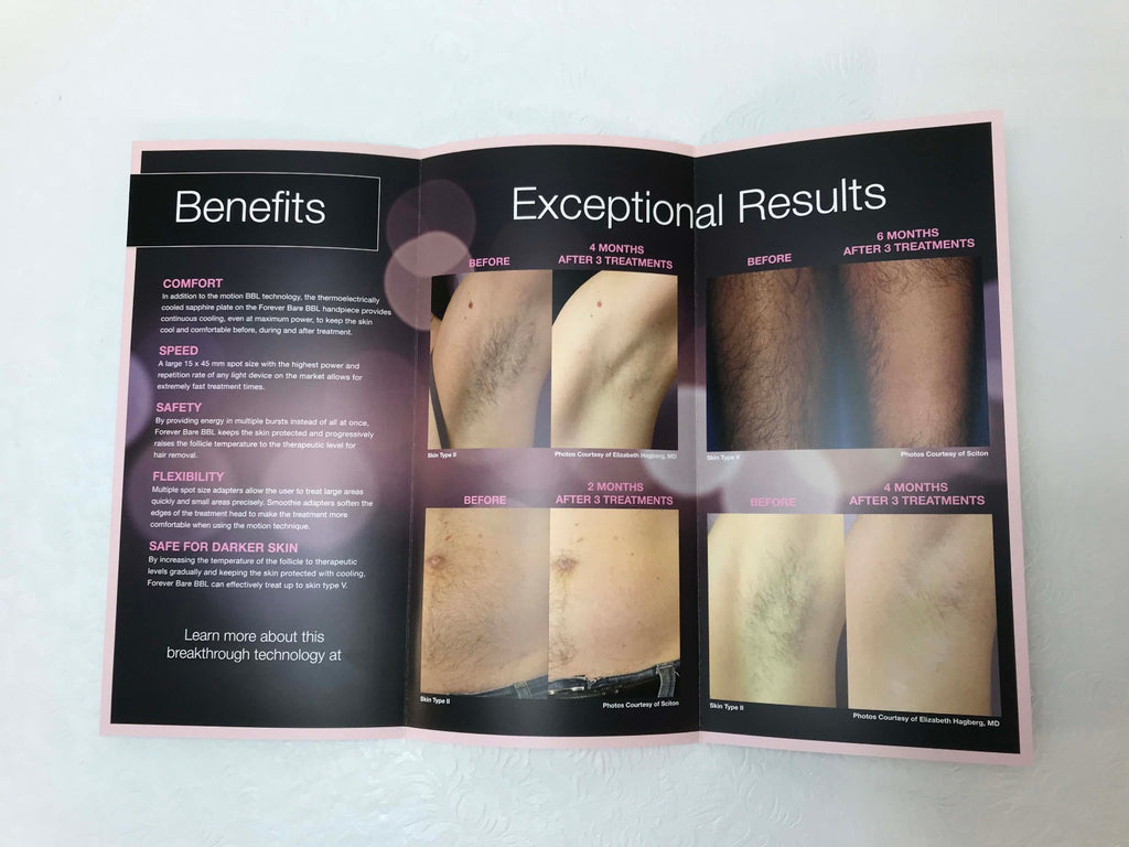 Sciton Lasers Forever Bare BBL IPL Hair Removal Patient Brochures 25 Pack