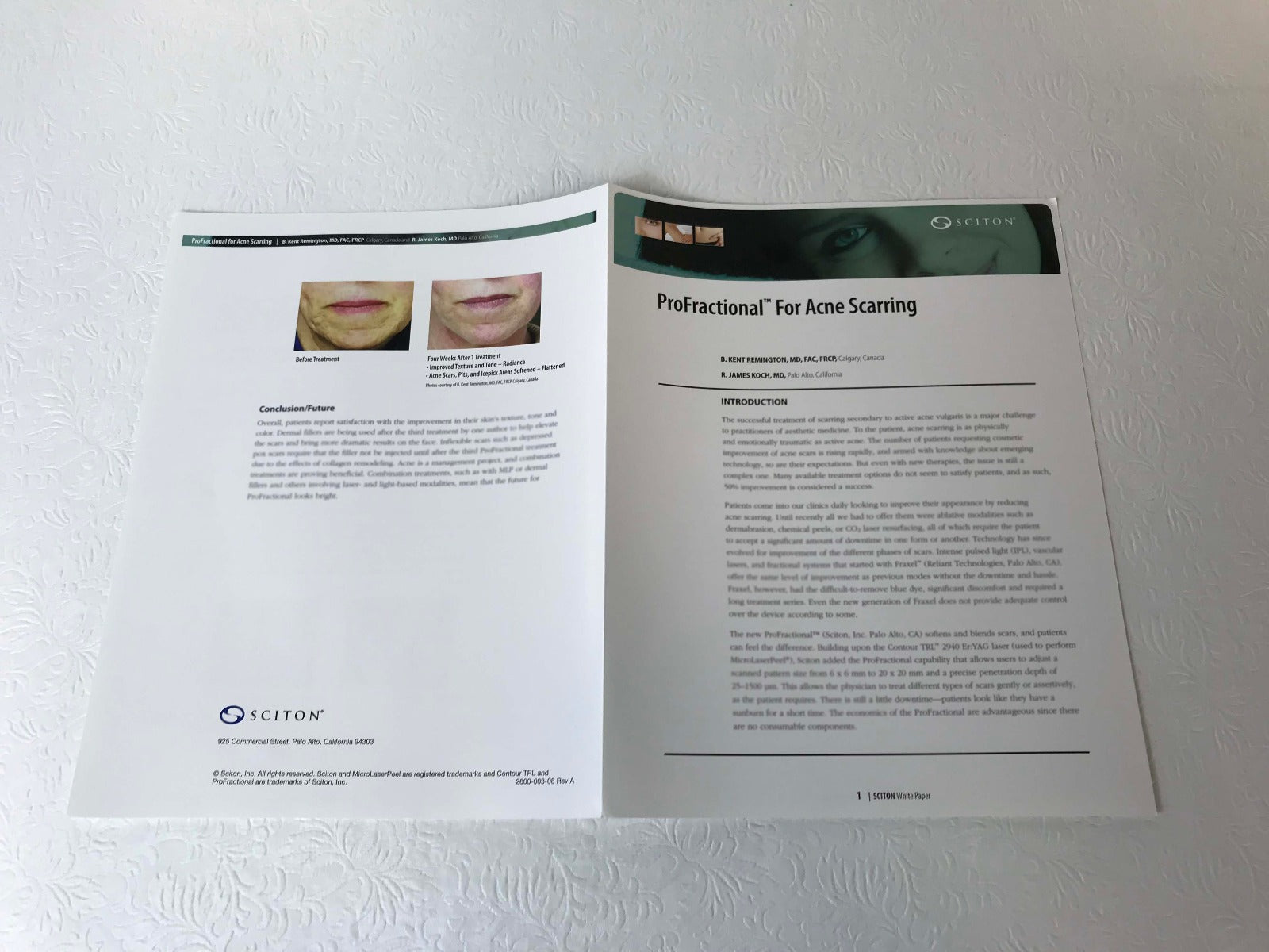 Sciton ProFractional Laser Acne Scarring Informative Clinical White Paper QTY 22