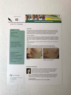 Sciton Joule Laser Contour TRL ProFractional Acne Scars Case Study One Sheet x25