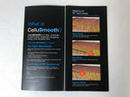 Sciton Joule CelluSmooth Laser Cellulite Reduction Patient Brochures QTY 25
