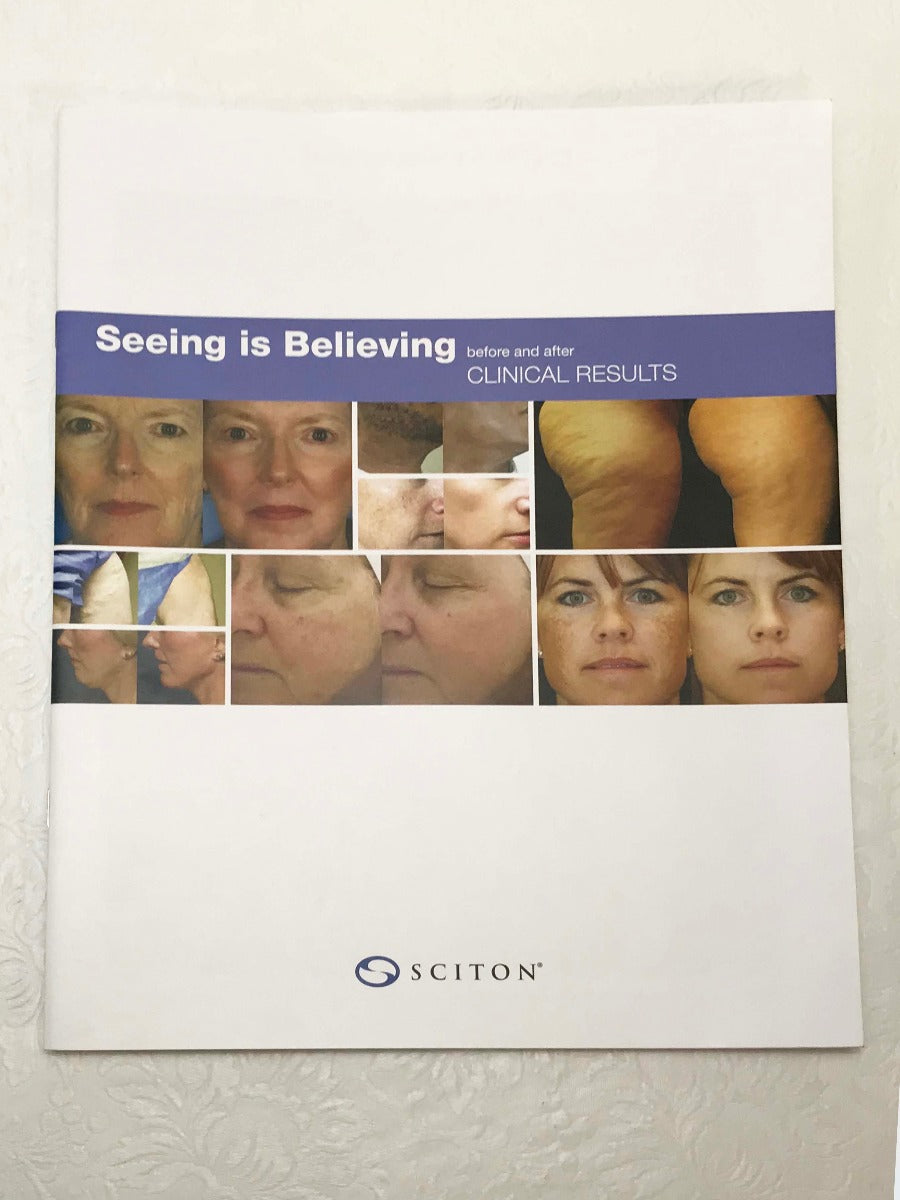 Sciton Joule Laser Seeing Is Believing Results Before & After Photo Book