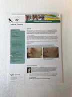 Sciton Joule Laser ProFractional Contour TRL Acne Scars Case Study One Sheet x19