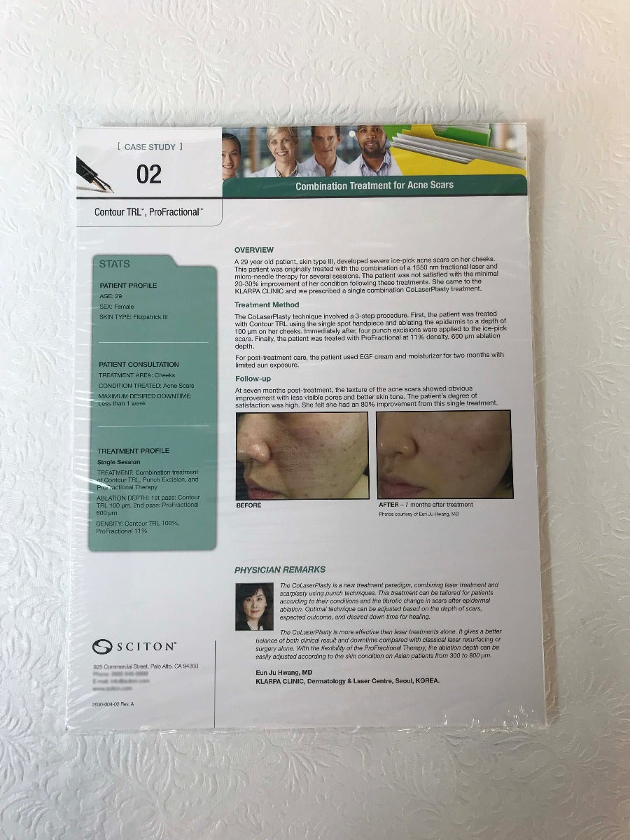 Sciton Joule Laser ProFractional Contour TRL Acne Scars Case Study One Sheet x19