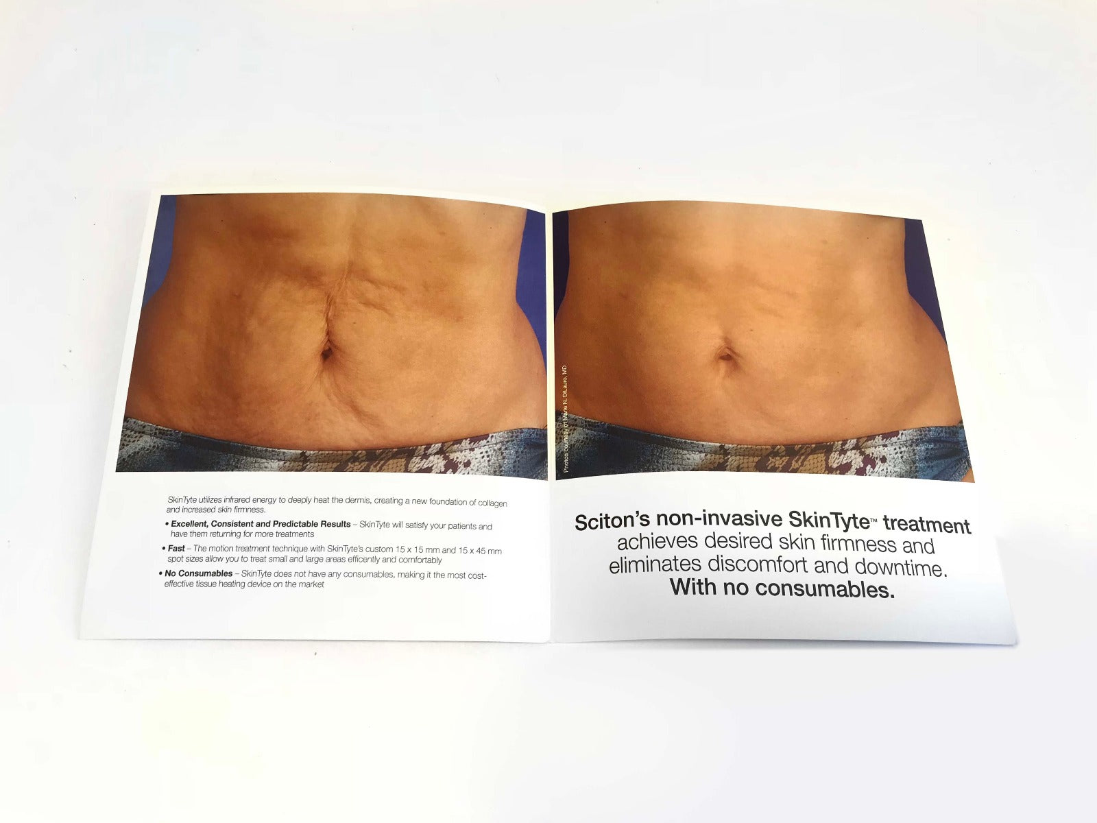 Sciton Joule SkinTyte BBL IPL Skin Firming Stomach Device Brochures Pack of 33