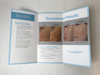 Sciton Joule Laser NanoLaserPeel Skin Resurfacing Patient Brochures 12 Pack