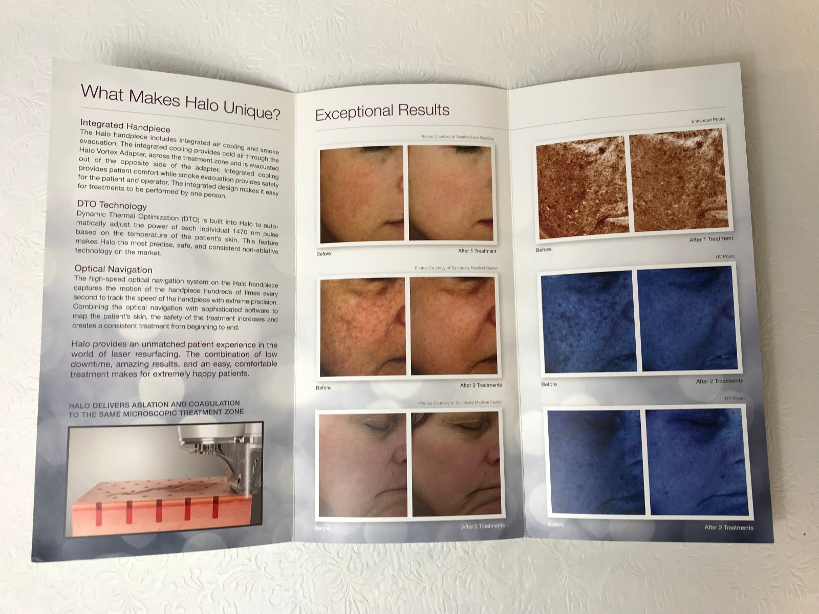 Sciton Joule Halo Non-Ablative Laser Skin Resurfacing Patient Brochures 9 Pack