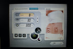 2016 Alma Diode Laser ALEX 755nm Platinum Soprano ICE Hair Removal Handpiece