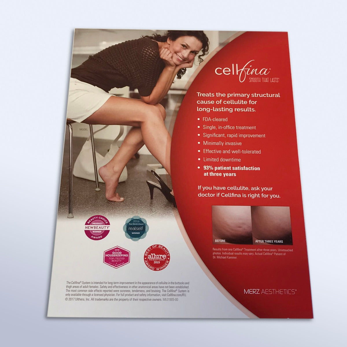 2017 Ulthera Cellfina Subcision Patient Marketing B&A Lobby Sign Display LARGE