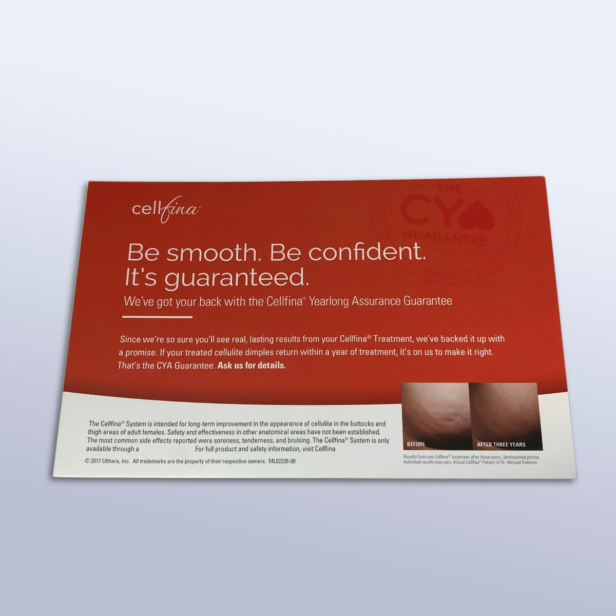 Ulthera Cellfina Patient Satisfaction Retreatment Guarantee Lobby Sign Display