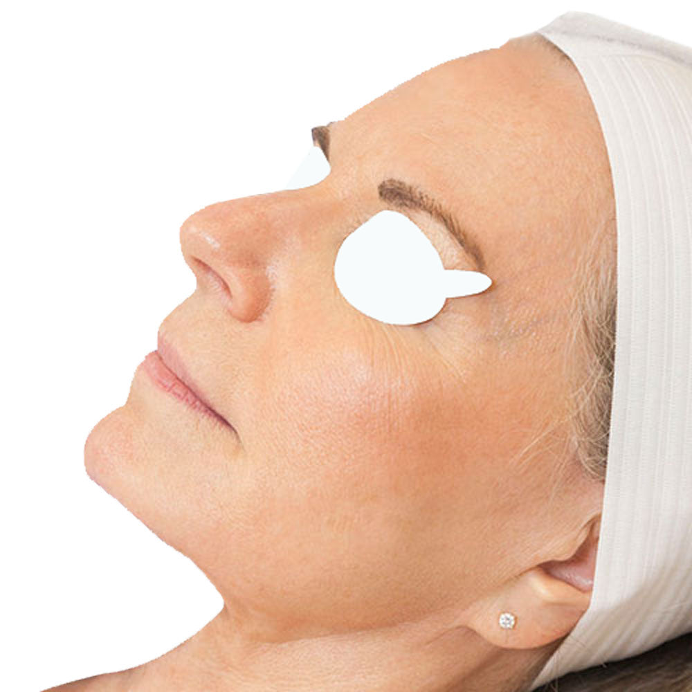 Innovative Optics Disposable Patient Laser Eye Shields LASER-AID 190-10600nm Box of 25 Pair