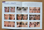 Lumenis UltraPulse Encore ActiveFX MaxFX Before After Result Photos Brochure