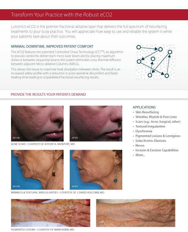 2008 Lutronic Surgical CO2 Laser eC02 Mosaic Skin Fractional Wrinkle Scar Lesion