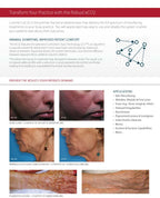 2008 Lutronic Surgical CO2 Laser eC02 Mosaic Skin Fractional Wrinkle Scar Lesion