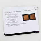 Lutronic Accufit Photography Guidance Practice Recommendations Guide