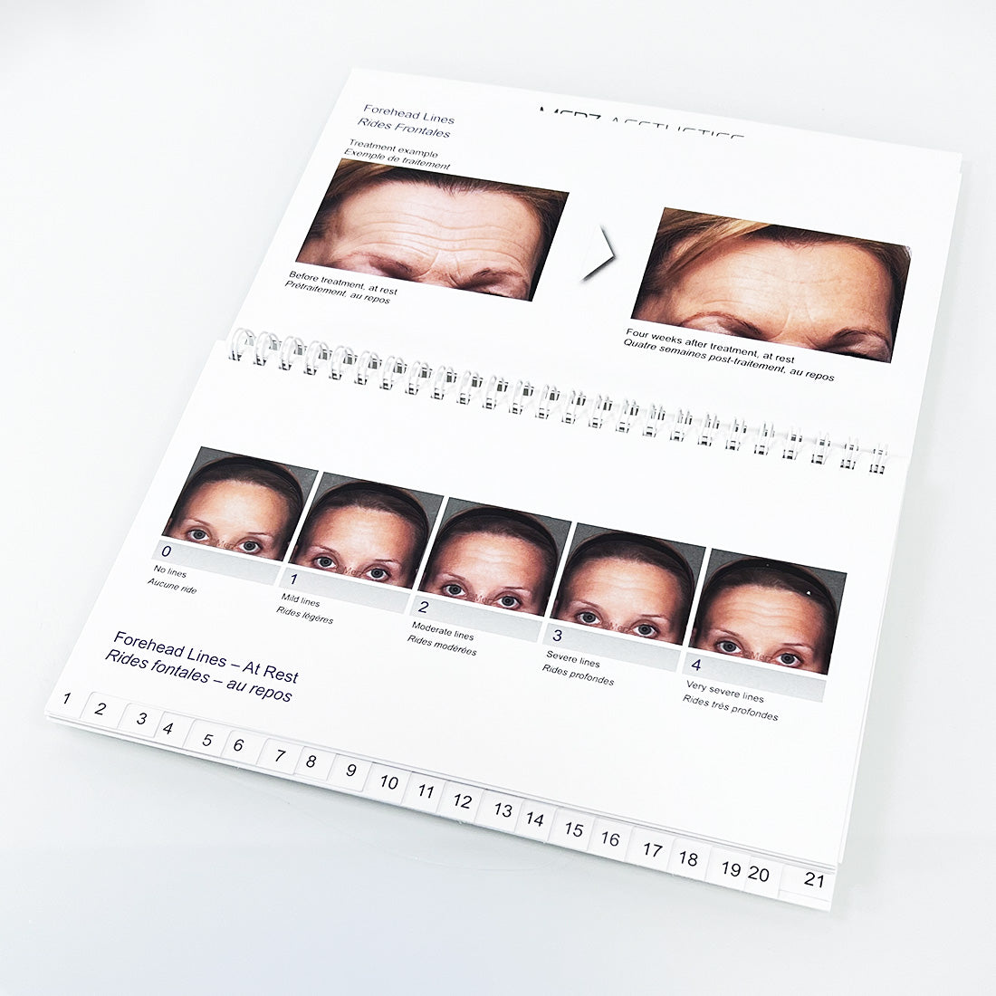 Merz Aesthetics Scales Patient Marketing Booklet 49738
