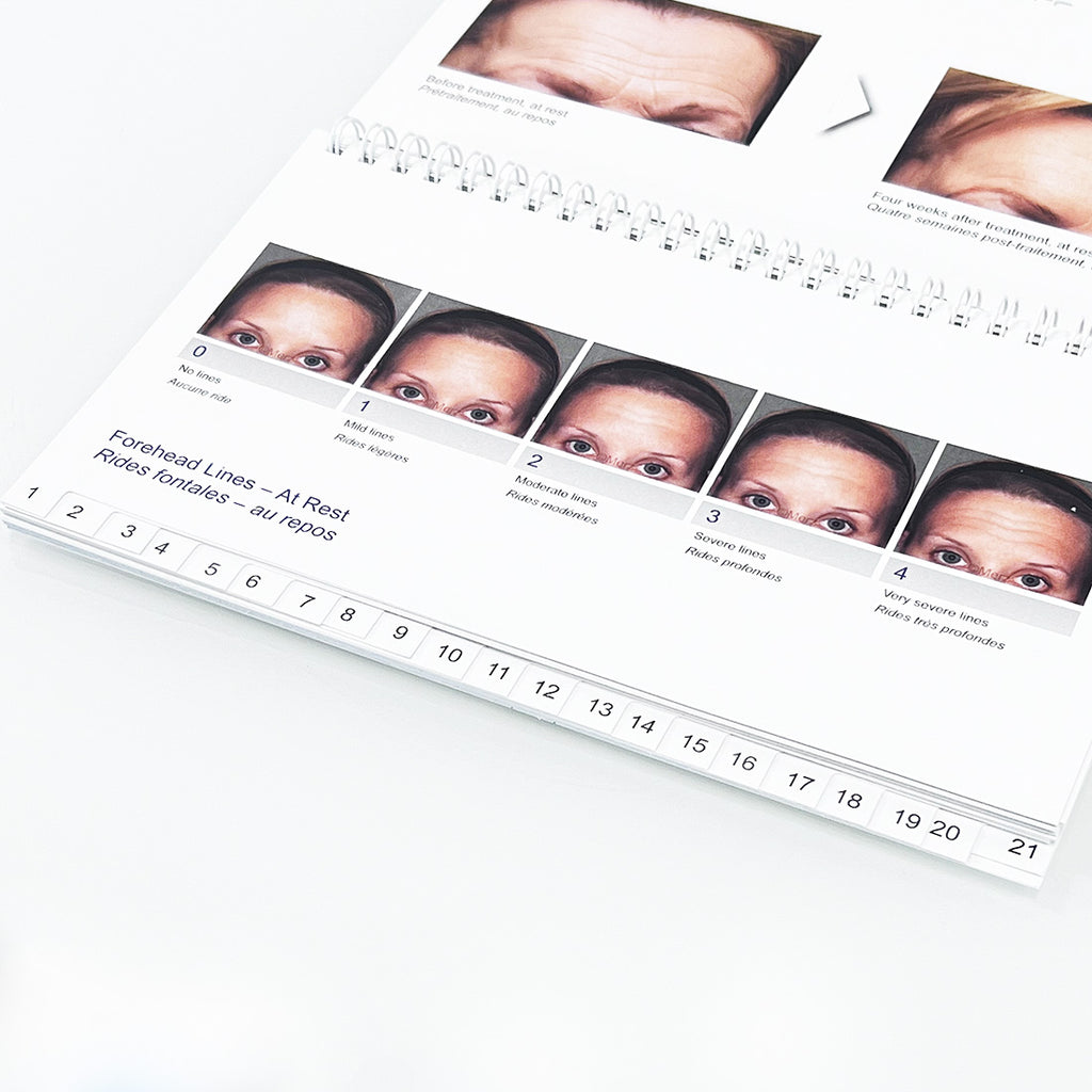 Merz Aesthetics Scales Patient Marketing Booklet 49738