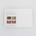Syneron Candela AlexTriVantage Unwanted Tattoos Relief Marketing Postcard x40Pc