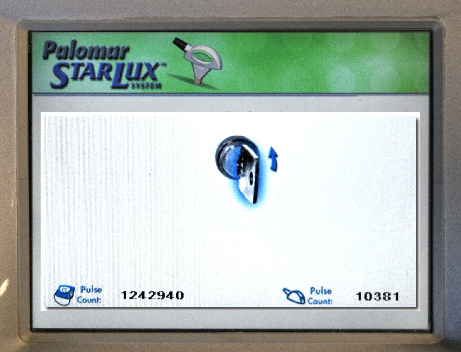 2010 Palomar StarLux 500 IPL Laser Hair Removal Skin Rejuvenation Lesions Acne