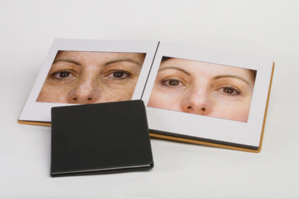 Laser Treatment Before and After Photo Books