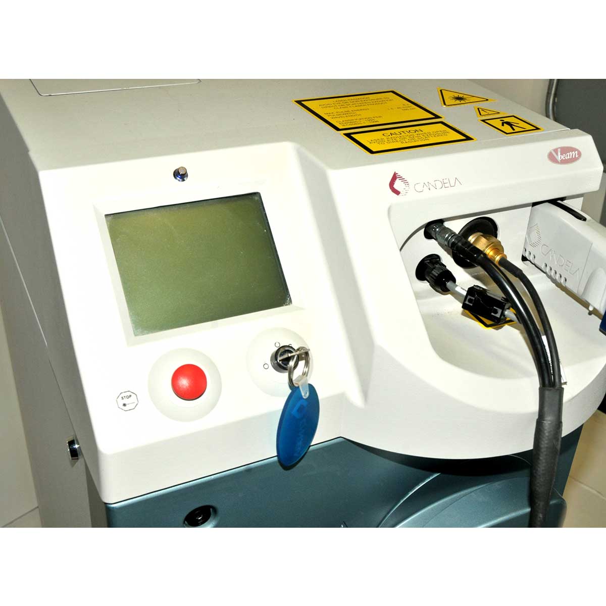 2006 Candela VBeam Wrinkles Scars Acne Stretch Marks Pulsed Dye Laser System