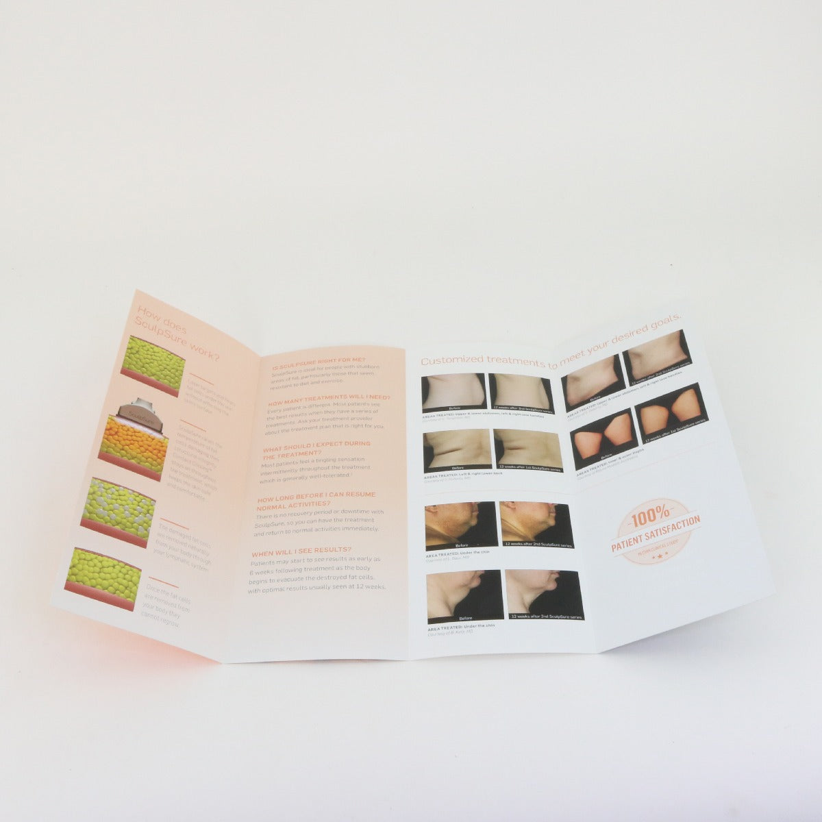 2017 Cynosure SculpSure Laser Body Sculpt Patient Brochures 921-7026-027 100pk