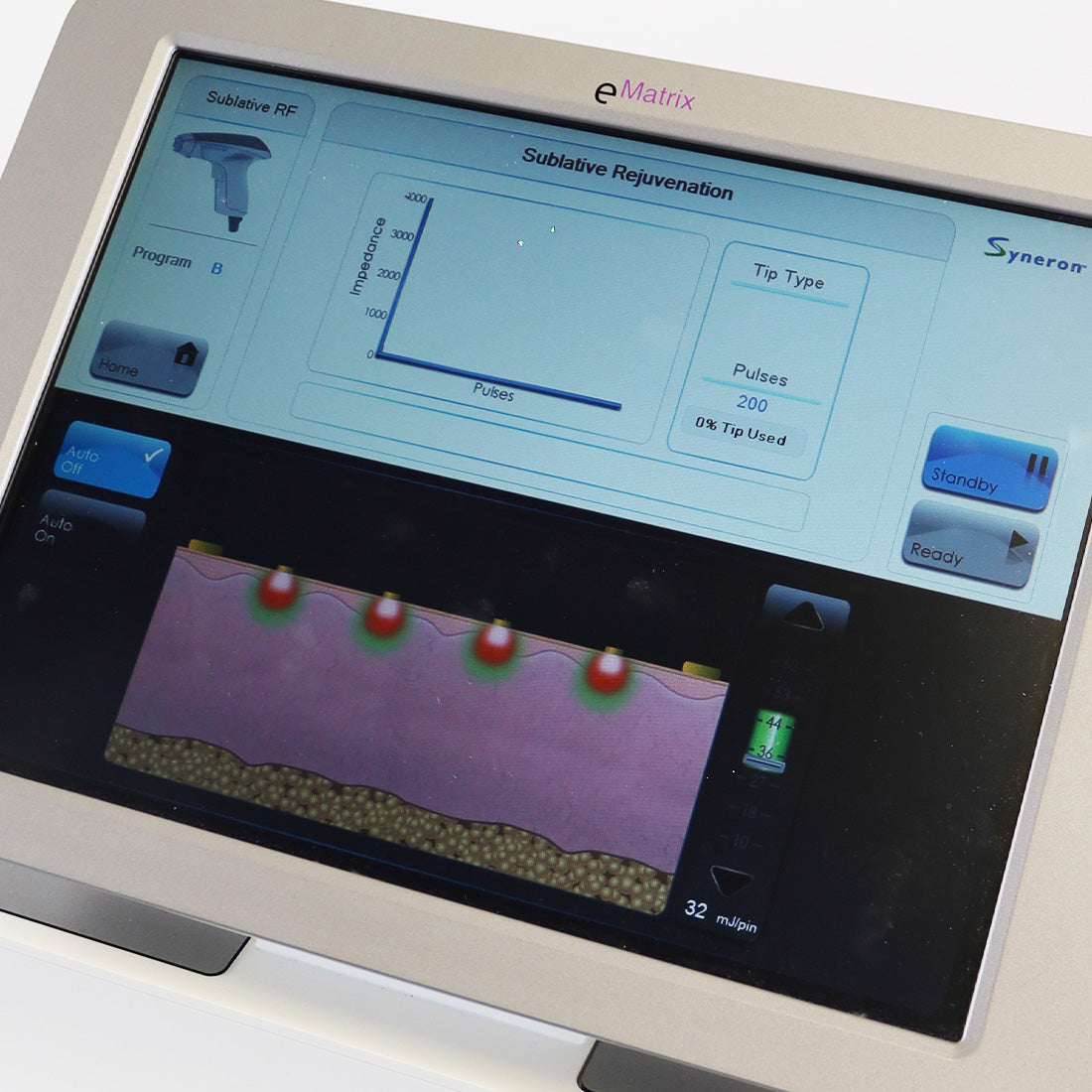 Syneron eMatrix Skin Rejuvenation TableTop Sublative RF System FG70442