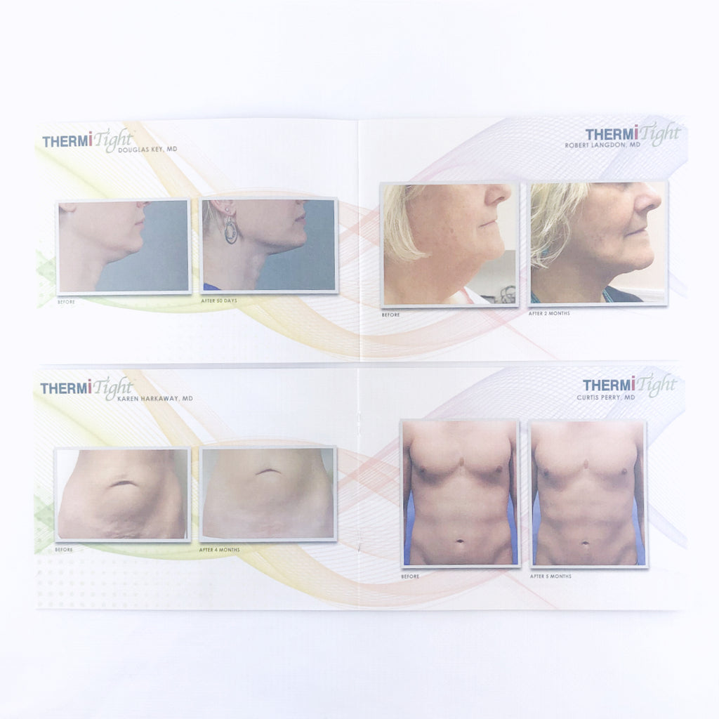 ThermiAesthetics ThermiRF Beauty Gallery Before & After Patient Lookbook - 10 Pack
