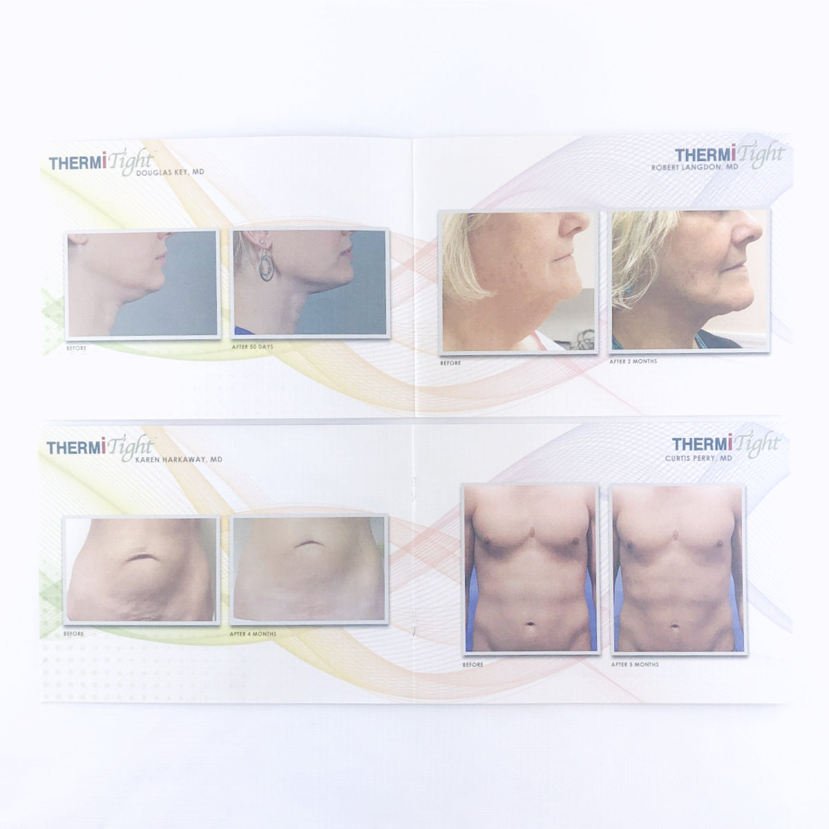 ThermiAesthetics ThermiRF Beauty Gallery Before & After Patient Lookbook - 10 Pack