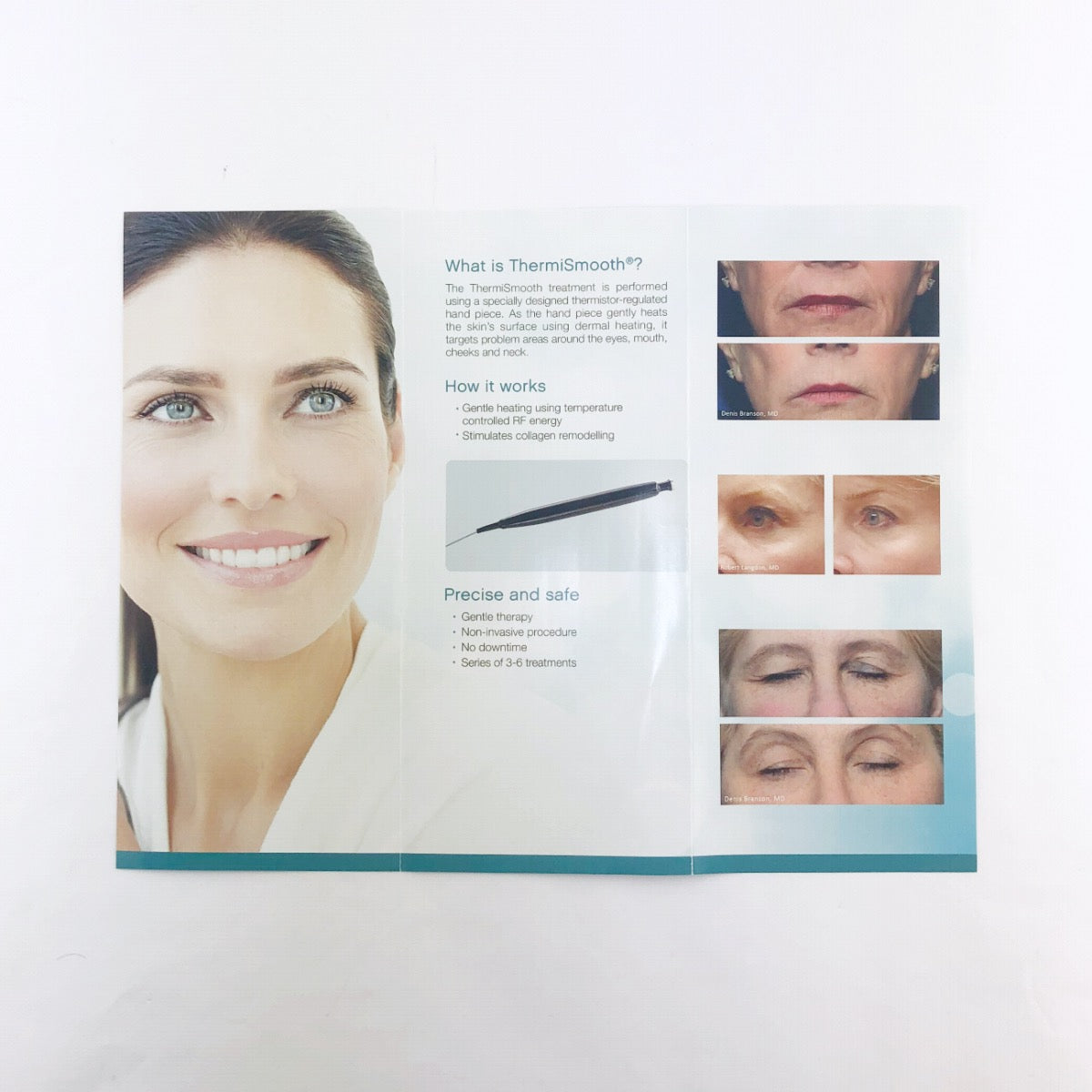 ThermiAesthetics ThermiSmooth Patient Brochures - 25 Pack