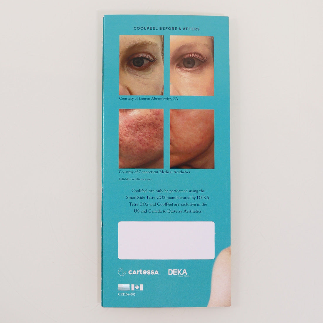 Deka Cartessa Coolpeel Reveal Healthier Younger-Looking Skin Brochure x6Pc