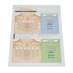 Ulthera Ultherapy Chest Patient Record Treatment Form 1001286C
