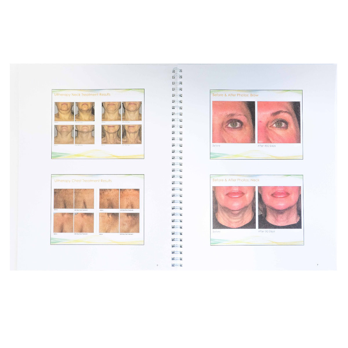 Ulthera Ultherapy Customer Training Book 1003213TRN