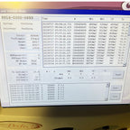 2007 Candela VBeam Perfecta Pulsed Vascular Acne Vein Laser System