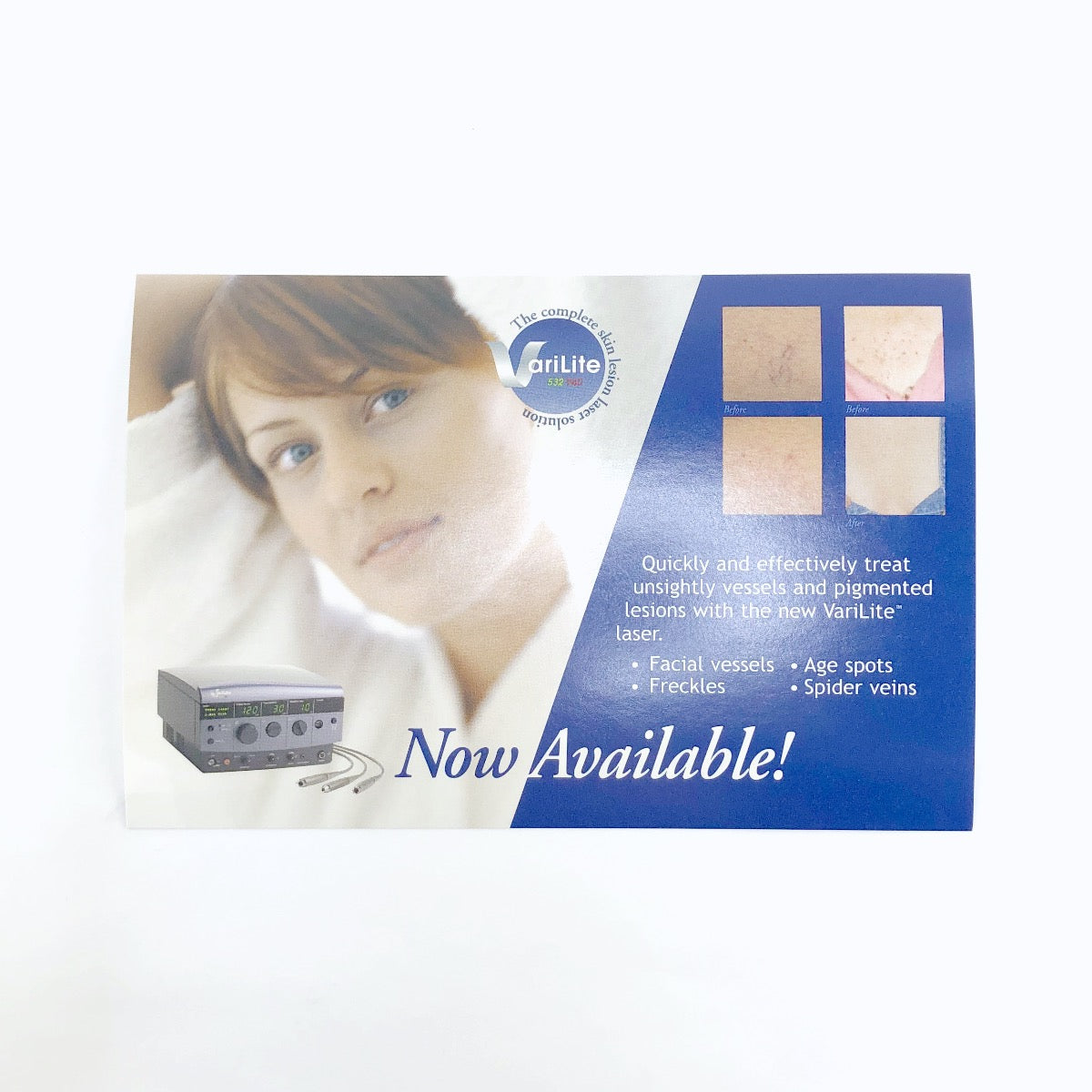 Varilite Laser System Patient Marketing Postcards 45251A - 50 Pack