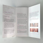 Vbeam Perfecta Skin Treatment Brochure 21 pcs