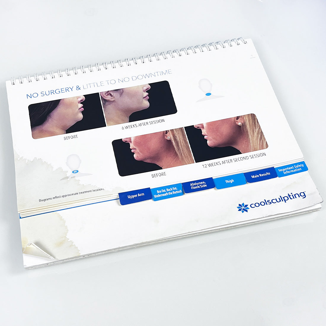 Zeltiq CoolSculpting CONSULTATION GUIDE Freeze Fat Reduction Guide 200111-G