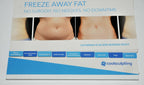 Zeltiq Coolsculpting Prop up Display FREEZE AWAY FAT Before/After Photos Guide
